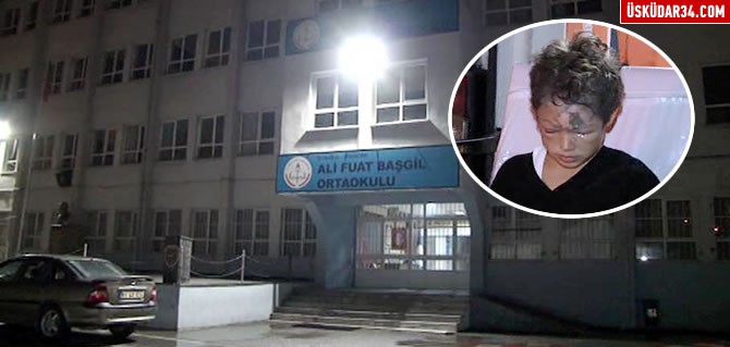 Üsküdar'daki bir okulda deney sırasında patlama oldu